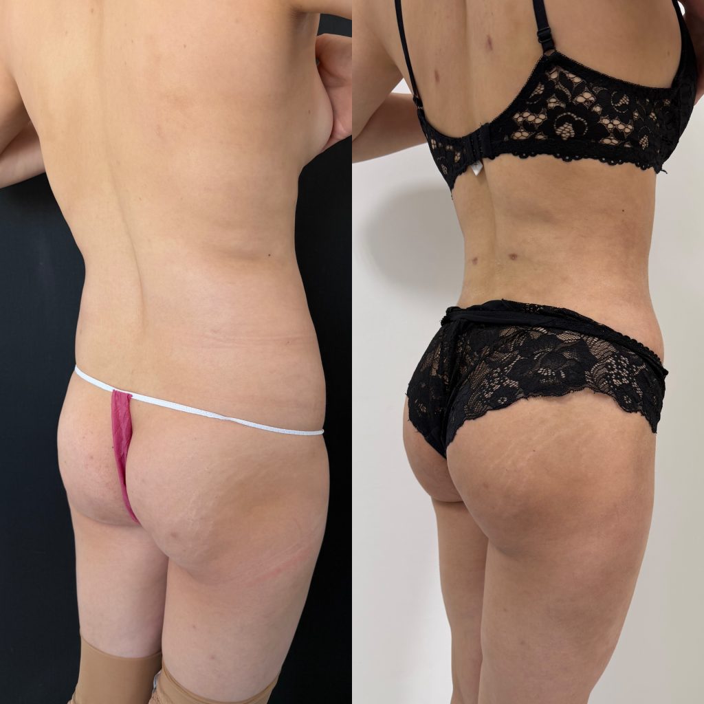 После